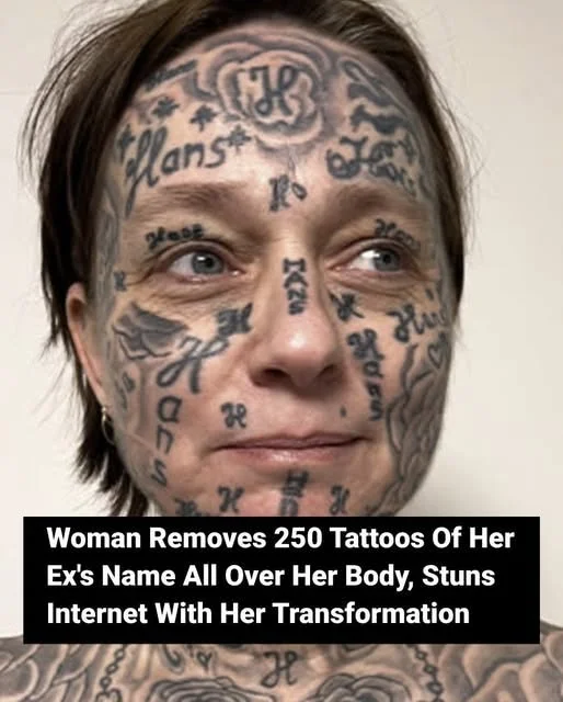 Woman Removes 250 Tattoos Of Her Ex’s Name All Over Her Body, Stuns Internet With Her Transformation