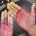 These are the consequences of sleeping with the…See more