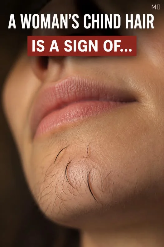Why Some Women Develop Chin Hair and What It Could Mean